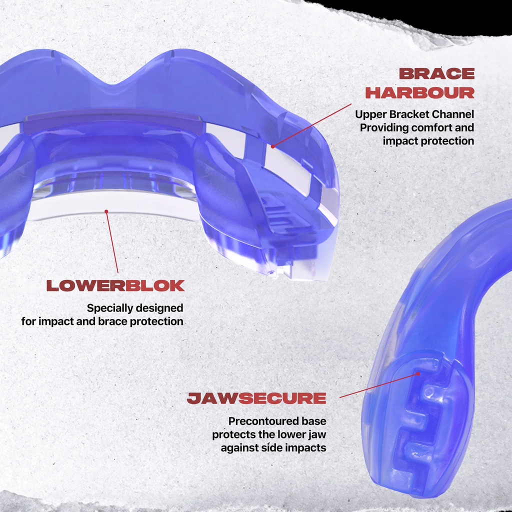 Safejawz Mundschutz für Zahnspangenträger Front Bracket, Blau