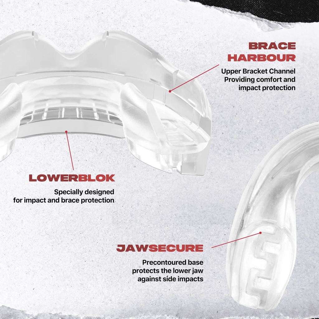 Safejawz Mundschutz für Zahnspangenträger Front Bracket, Transparent 3