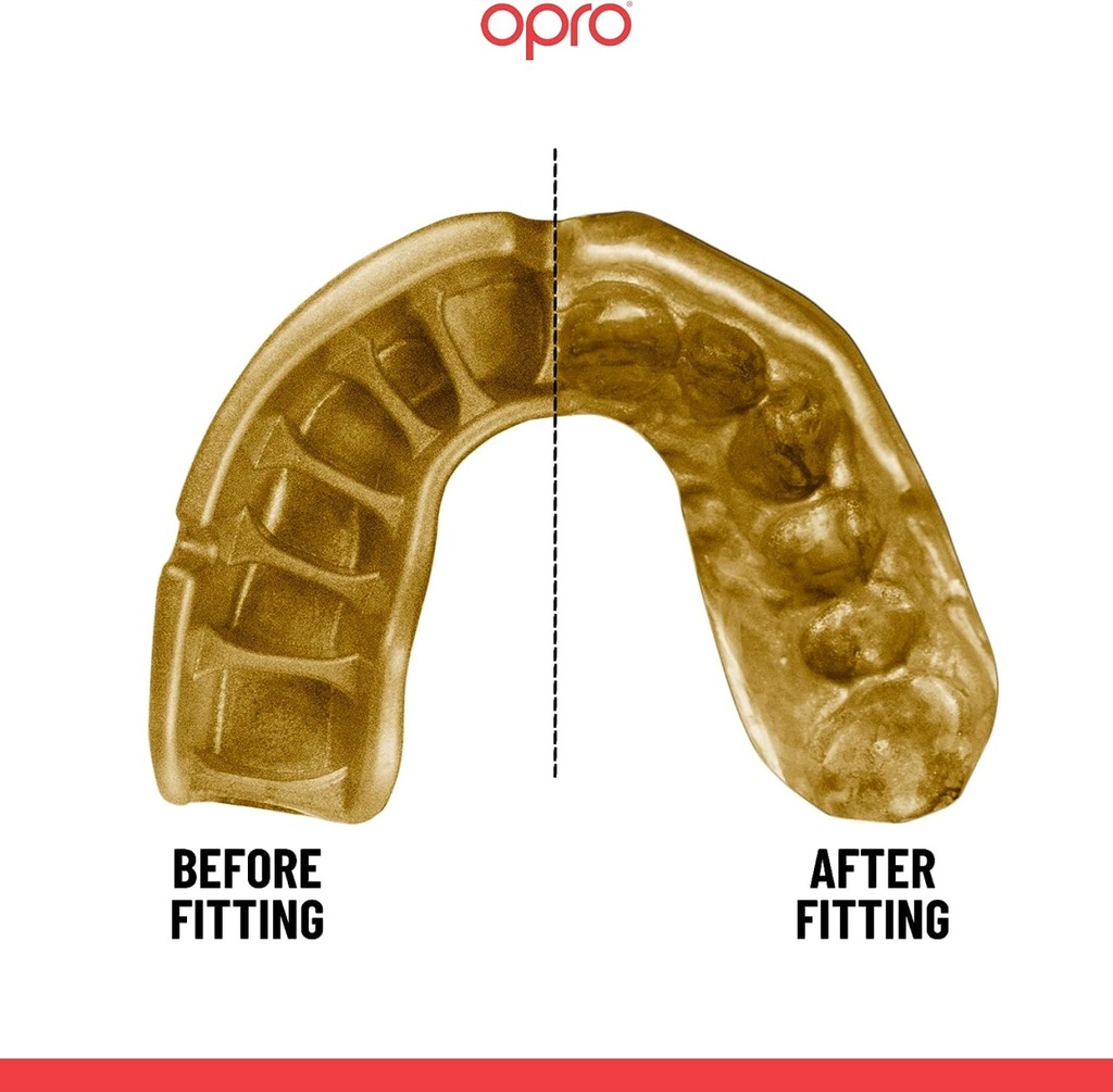 Opro Mundschutz Gold Grillz, Schwarz-Gold 4