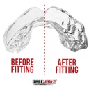 Safejawz Mundschutz Intro Serie, Transparent 2